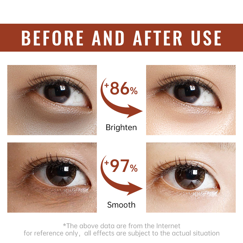 Retinol Straffende Augencreme  – Women Bags Under Eyes Bewertung und Preis